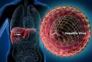 Cara Alami Mengobati Hepatitis